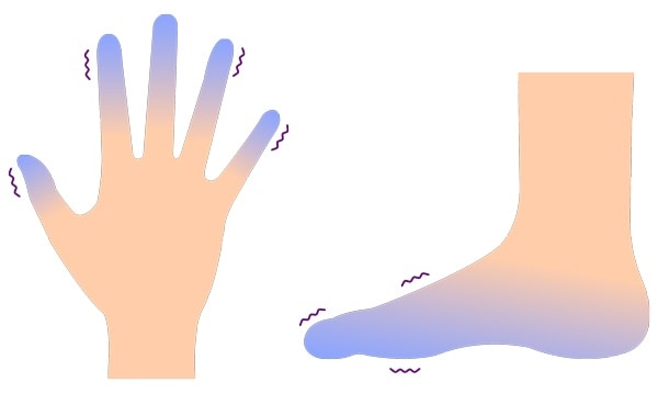 Raynaud's Disease